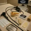 Echoendoscopie pancréatique : un examen clé de la biotech médicale pour le diagnostic du pancréas